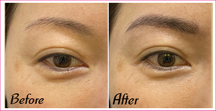 Eyebrow Microblading