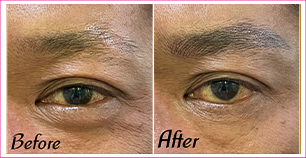 Man Eyebrow Microblading